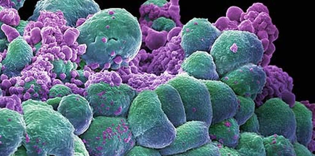 Breast Cancer and Cannabis Treatment