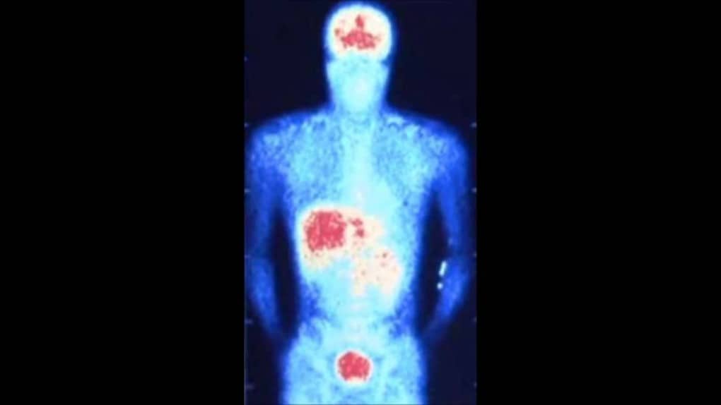 Using the Endocannabinoid System to Track Different Types of Tissue